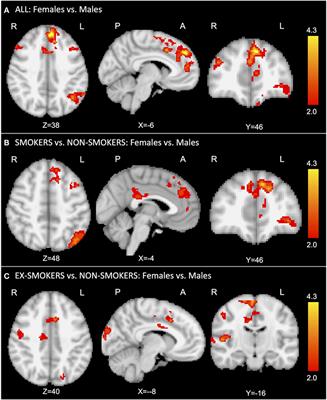 Sex Effects on Smoking Cue Perception in Non-Smokers, Smokers, and Ex-Smokers: A Pilot Study